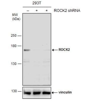 Knockdown Validated: ROCK2 Antibody [NBP2-20199]