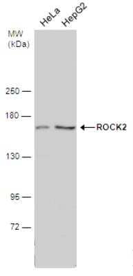 Western Blot: ROCK2 Antibody [NBP2-20199]