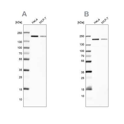 Western Blot: ROCK2 Antibody [NBP2-58122]