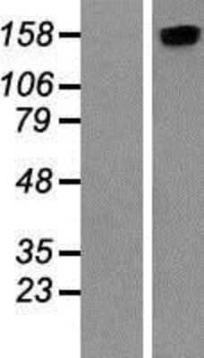Western Blot: ROCK2 Overexpression Lysate [NBP2-07810]
