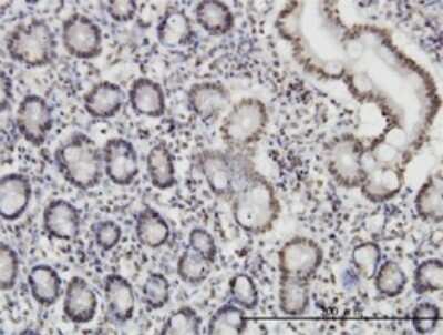 Immunohistochemistry-Paraffin: ROD1 Antibody (4C9) [H00009991-M01]