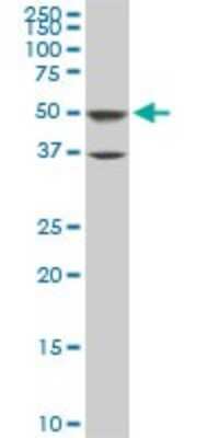 Western Blot: ROD1 Antibody (4C9) [H00009991-M01]