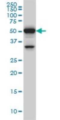 Western Blot: ROD1 Antibody (4C9) [H00009991-M01]