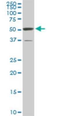 Western Blot: ROD1 Antibody (4C9) [H00009991-M01]