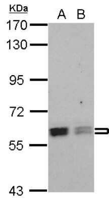 Western Blot: ROD1 Antibody [NBP2-15101]