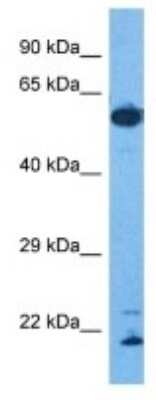 Western Blot: ROD1 Antibody [NBP3-09994]