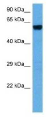 Western Blot: ROD1 Antibody [NBP3-11006]