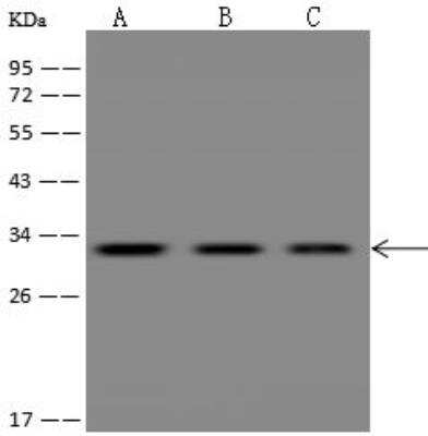 Western Blot: ROGDI Antibody [NBP3-12690]