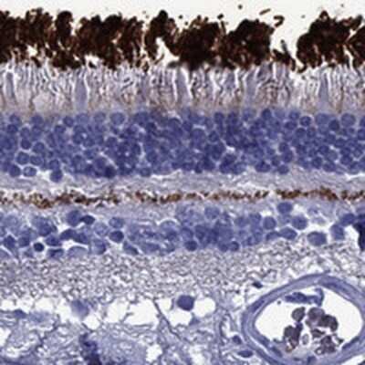 Immunohistochemistry-Paraffin: ROM1 Antibody [NBP3-17927]