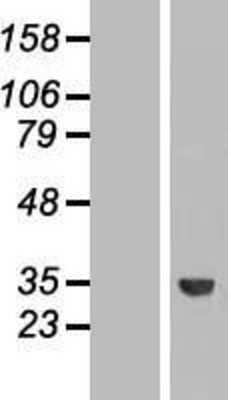 Western Blot: ROM1 Overexpression Lysate [NBL1-15475]