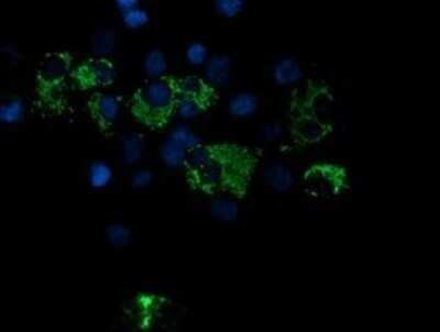 Immunocytochemistry/ Immunofluorescence: ROMO1 Antibody (OTI2C12) - Azide and BSA Free [NBP2-73928]