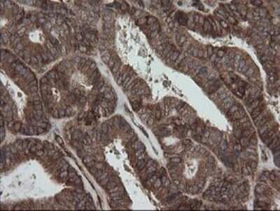 Immunohistochemistry: ROMO1 Antibody (OTI2C12) - Azide and BSA Free [NBP2-73928]