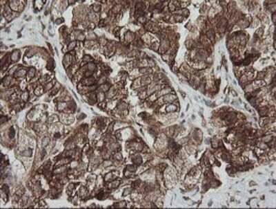 Immunohistochemistry: ROMO1 Antibody (OTI2C12) - Azide and BSA Free [NBP2-73928]