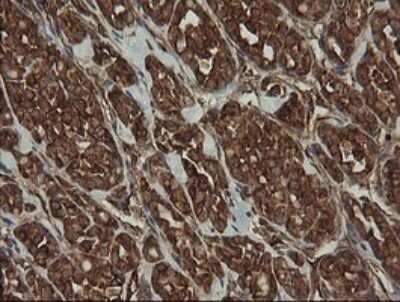 Immunohistochemistry: ROMO1 Antibody (OTI2C12) - Azide and BSA Free [NBP2-73928]