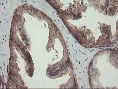 Immunohistochemistry: ROMO1 Antibody (OTI2C12) - Azide and BSA Free [NBP2-73928]