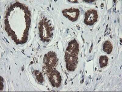 Immunohistochemistry: ROMO1 Antibody (OTI2C12) [NBP2-45607]