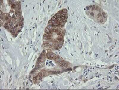 Immunohistochemistry: ROMO1 Antibody (OTI2C12) [NBP2-45607]