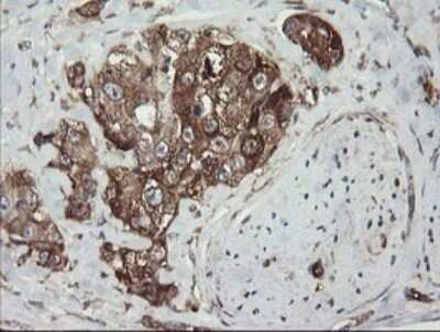 Immunohistochemistry: ROMO1 Antibody (OTI2C12) [NBP2-45607]