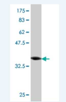 Western Blot: ROPN1 Antibody (1B10) [H00054763-M04]