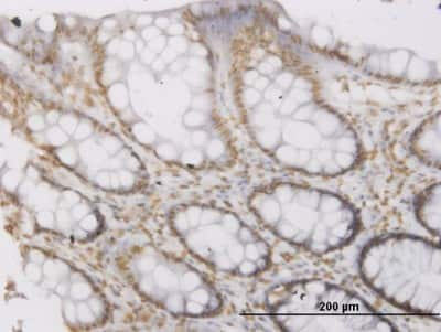 Immunohistochemistry-Paraffin: ROPN1 Antibody (4E11) [H00054763-M03]