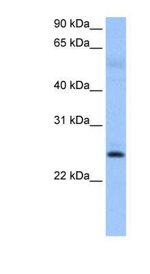 Western Blot: ROPN1B Antibody [NBP1-56358]