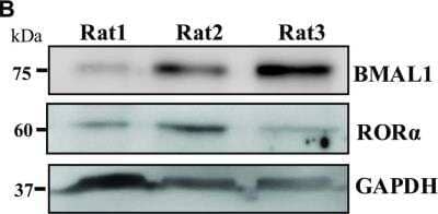 Western Blot: ROR alpha/NR1F1 Antibody [NBP1-52813]