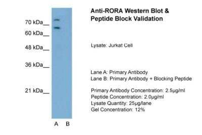 Western Blot: ROR alpha/NR1F1 Antibody [NBP1-52828]