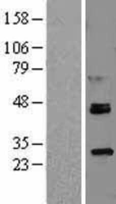 Western Blot: ROR alpha/NR1F1 Overexpression Lysate [NBL1-15479]