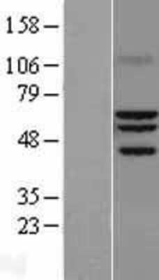 Western Blot: ROR alpha/NR1F1 Overexpression Lysate [NBL1-15480]