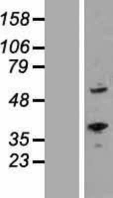 Western Blot: ROR alpha/NR1F1 Overexpression Lysate [NBP2-05658]