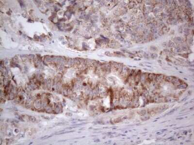 Immunohistochemistry: ROR beta Antibody (OTI1G1) [NBP2-45610]