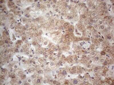 Immunohistochemistry: ROR beta Antibody (OTI1G1) [NBP2-45610]