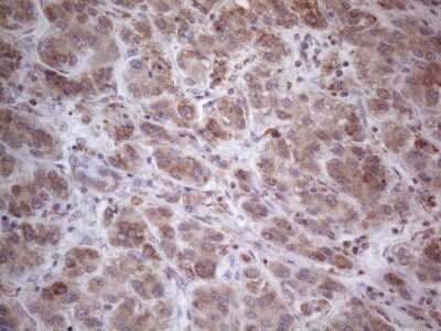 Immunohistochemistry: ROR beta Antibody (OTI1G1) [NBP2-45610]