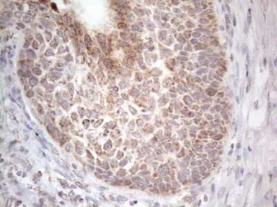 Immunohistochemistry: ROR beta Antibody (OTI1G1) [NBP2-45610]
