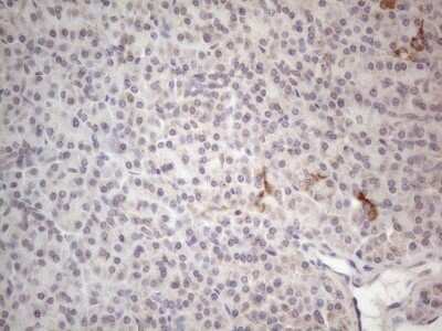 Immunohistochemistry: ROR beta Antibody (OTI1G1) [NBP2-45610]