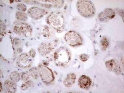 Immunohistochemistry: ROR beta Antibody (OTI1G1) [NBP2-45610]