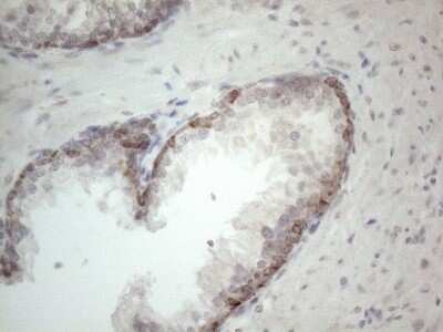 Immunohistochemistry: ROR beta Antibody (OTI1G1) [NBP2-45610]