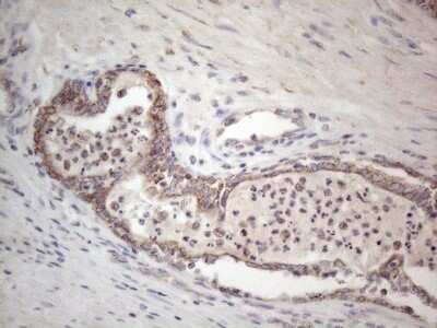 Immunohistochemistry: ROR beta Antibody (OTI1G1) [NBP2-45610]