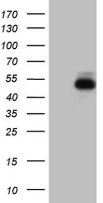 Western Blot: ROR beta Antibody (OTI1G1) [NBP2-45610]