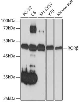 Western Blot: ROR beta Antibody (7J9T7) [NBP3-15895]