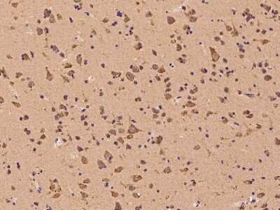 Immunohistochemistry-Paraffin: ROR beta Antibody [NBP2-97604]