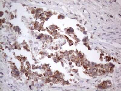 Immunohistochemistry: ROR beta Antibody (OTI1G1) - Azide and BSA Free [NBP2-73930]
