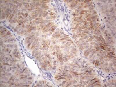 Immunohistochemistry: ROR beta Antibody (OTI1G1) - Azide and BSA Free [NBP2-73930]