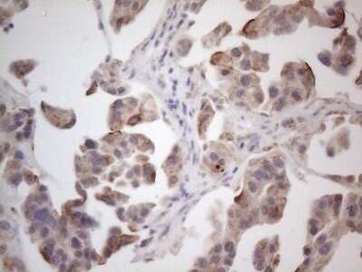 Immunohistochemistry: ROR beta Antibody (OTI1G1) - Azide and BSA Free [NBP2-73930]