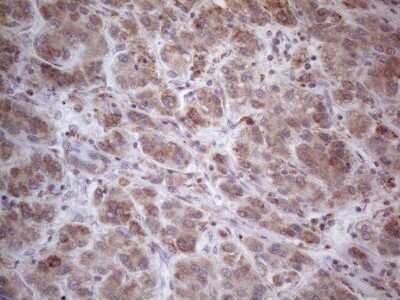 Immunohistochemistry: ROR beta Antibody (OTI1G1) - Azide and BSA Free [NBP2-73930]