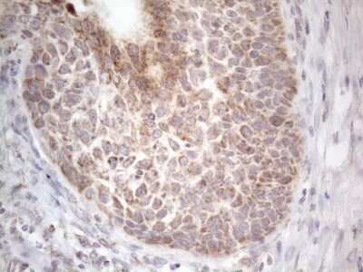 Immunohistochemistry: ROR beta Antibody (OTI1G1) - Azide and BSA Free [NBP2-73930]