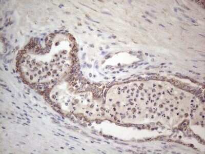 Immunohistochemistry: ROR beta Antibody (OTI1G1) - Azide and BSA Free [NBP2-73930]