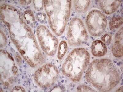 Immunohistochemistry: ROR beta Antibody (OTI1G1) - Azide and BSA Free [NBP2-73930]