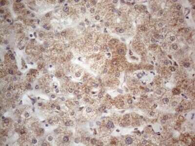 Immunohistochemistry: ROR beta Antibody (OTI1G1) - Azide and BSA Free [NBP2-73930]