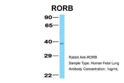 Western Blot: ROR beta Antibody [NBP2-88172]